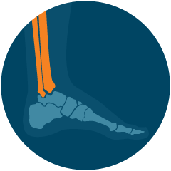 3D image depicting the pain in the leg of a patient in Maryland