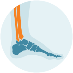 3D image depicting the pain in the leg of a patient in Maryland