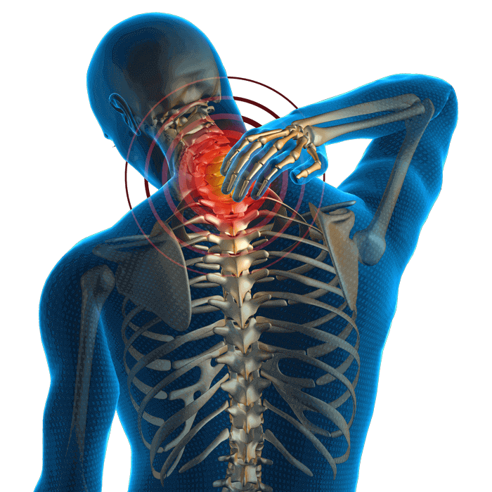 X-ray image of a patient experiencing backache seeking pain relief treatment in Maryland