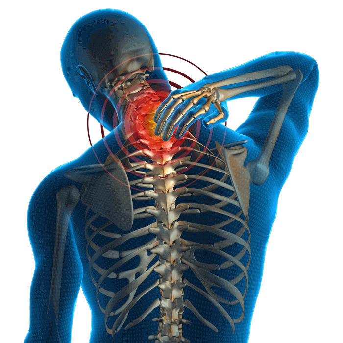 Think You Have a Pinched Nerve? - Baltimore MD Physical Therapy for Sports  and Injury Rehab