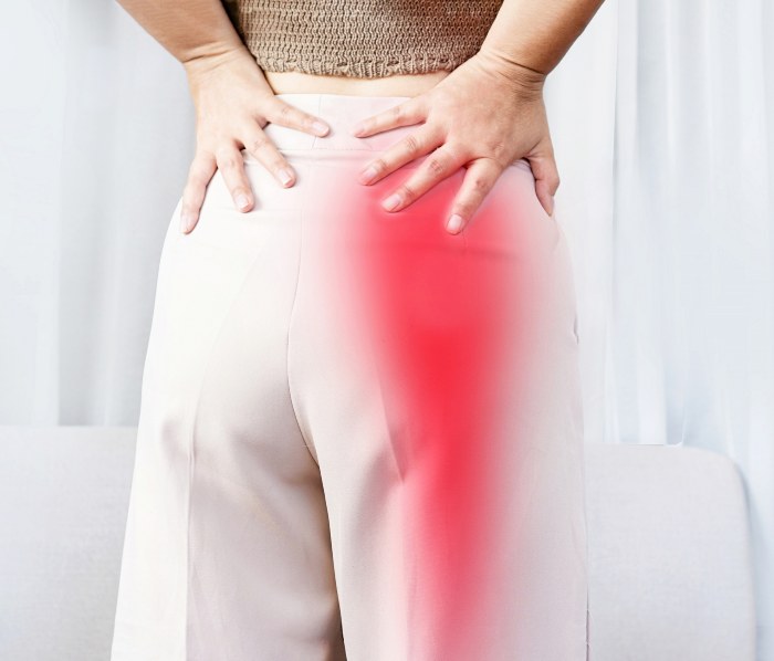 Woman suffering from Sciatica pain spreading from buttock to leg